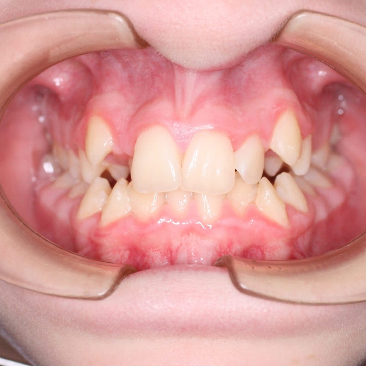 Imagen - Ortodoncia Más Allá de la Estética